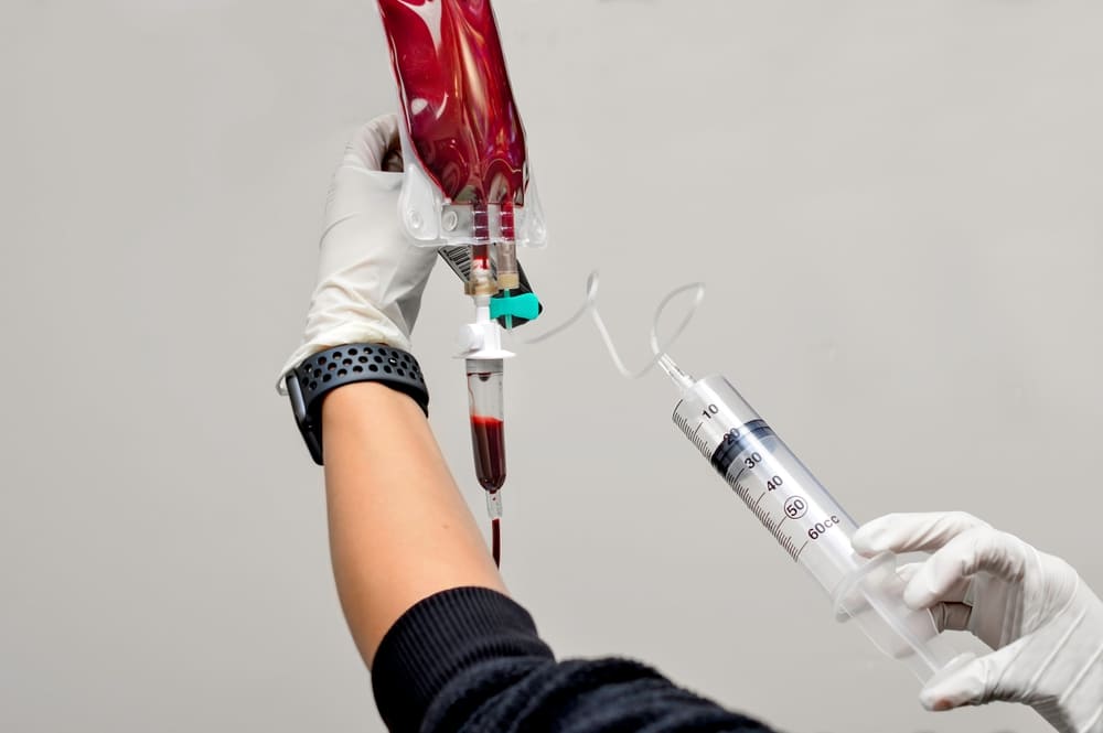 Nurse injecting ozone into an IV bag full of the patient's blood for a single dose ozone therapy treatment.