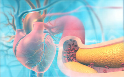 3 Common Cholesterol Misconceptions