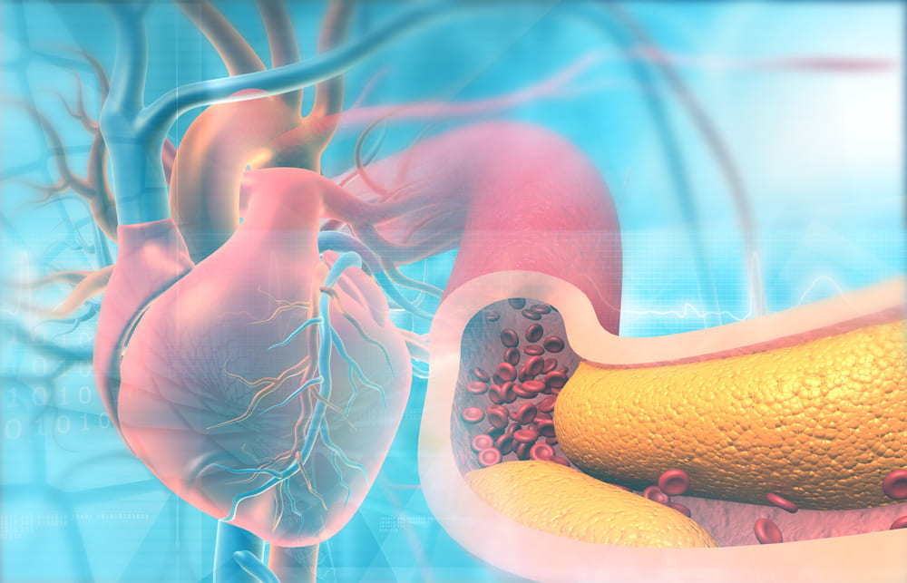 Human heart with clogged arteries. 3d illustration