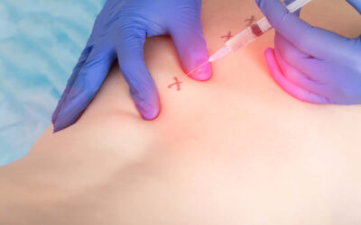 Procaine: The Magical Anesthetic in Regenerative Therapies